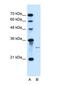 Sonic hedgehog protein antibody, NBP1-69270, Novus Biologicals, Western Blot image 