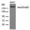 Erb-B2 Receptor Tyrosine Kinase 3 antibody, AP08087PU-N, Origene, Western Blot image 