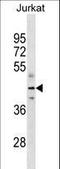 Fumarate Hydratase antibody, LS-C159655, Lifespan Biosciences, Western Blot image 