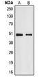 E2F Transcription Factor 2 antibody, LS-C352136, Lifespan Biosciences, Western Blot image 