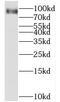 HPS4 Biogenesis Of Lysosomal Organelles Complex 3 Subunit 2 antibody, FNab04000, FineTest, Western Blot image 