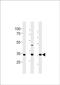 Cell Growth Regulator With EF-Hand Domain 1 antibody, PA5-49320, Invitrogen Antibodies, Western Blot image 