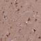 ST6 N-Acetylgalactosaminide Alpha-2,6-Sialyltransferase 5 antibody, NBP2-49632, Novus Biologicals, Immunohistochemistry frozen image 