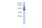 NOP2/Sun RNA Methyltransferase 3 antibody, A16002, Boster Biological Technology, Western Blot image 