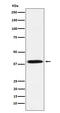 NFKB Inhibitor Alpha antibody, P01139-1, Boster Biological Technology, Western Blot image 