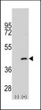 SEK1 antibody, TA300116, Origene, Western Blot image 