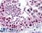 Metastasis Associated 1 Family Member 2 antibody, LS-B1771, Lifespan Biosciences, Immunohistochemistry frozen image 