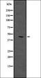 Pleckstrin Homology Like Domain Family A Member 1 antibody, orb335200, Biorbyt, Western Blot image 