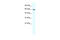 Iroquois Homeobox 1 antibody, 27-890, ProSci, Western Blot image 