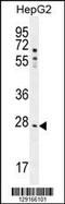 Nuclear Receptor Subfamily 0 Group B Member 2 antibody, 55-606, ProSci, Western Blot image 