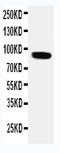 Transient Receptor Potential Cation Channel Subfamily V Member 2 antibody, LS-C313107, Lifespan Biosciences, Western Blot image 