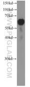 Lipopolysaccharide Binding Protein antibody, 66181-1-Ig, Proteintech Group, Western Blot image 