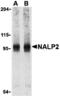 NLR Family Pyrin Domain Containing 2 antibody, MBS150327, MyBioSource, Western Blot image 