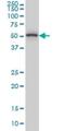 Thyroid Hormone Receptor Interactor 6 antibody, H00007205-M04, Novus Biologicals, Western Blot image 