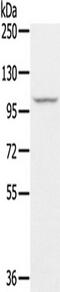 StAR Related Lipid Transfer Domain Containing 8 antibody, TA350456, Origene, Western Blot image 