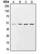 Casein Kinase 1 Gamma 2 antibody, LS-C352060, Lifespan Biosciences, Western Blot image 