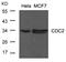 Cyclin Dependent Kinase 1 antibody, 79-377, ProSci, Western Blot image 