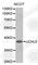 Ubiquitin C-Terminal Hydrolase L5 antibody, A1090, ABclonal Technology, Western Blot image 