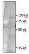 Toll Like Receptor 5 antibody, NBP1-97728, Novus Biologicals, Western Blot image 