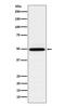 RuvB Like AAA ATPase 1 antibody, M02049, Boster Biological Technology, Western Blot image 