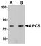 Anaphase Promoting Complex Subunit 5 antibody, NBP1-77154, Novus Biologicals, Western Blot image 