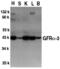 GDNF Family Receptor Alpha 3 antibody, 1137, QED Bioscience, Western Blot image 