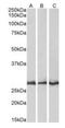 F-actin-capping protein subunit beta antibody, orb18652, Biorbyt, Western Blot image 