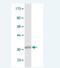 ADP/ATP translocase 3 antibody, H00000293-M02, Novus Biologicals, Western Blot image 