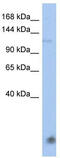 HECT And RLD Domain Containing E3 Ubiquitin Protein Ligase 5 antibody, TA329858, Origene, Western Blot image 