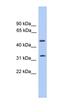 Tumor Protein P63 Regulated 1 antibody, orb326044, Biorbyt, Western Blot image 