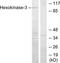 Hexokinase 3 antibody, TA314005, Origene, Western Blot image 