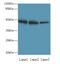 Zinc Finger And BTB Domain Containing 6 antibody, LS-C377527, Lifespan Biosciences, Western Blot image 