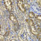 N-Myristoyltransferase 2 antibody, A7042, ABclonal Technology, Immunohistochemistry paraffin image 