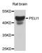 Pellino E3 Ubiquitin Protein Ligase 1 antibody, STJ110539, St John