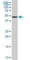 UDP-Glucose Pyrophosphorylase 2 antibody, H00007360-M01, Novus Biologicals, Western Blot image 