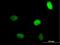 Zinc Finger Protein 35 antibody, H00007584-B01P, Novus Biologicals, Immunocytochemistry image 