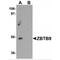Zinc Finger And BTB Domain Containing 9 antibody, MBS150950, MyBioSource, Western Blot image 