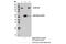 p130cas antibody, 13846S, Cell Signaling Technology, Immunoprecipitation image 