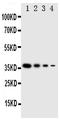 Linker For Activation Of T Cells Family Member 2 antibody, PA2039, Boster Biological Technology, Western Blot image 