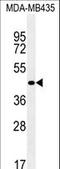 Zinc Finger Protein 625 antibody, LS-C160923, Lifespan Biosciences, Western Blot image 