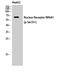 Nuclear Receptor Subfamily 4 Group A Member 1 antibody, STJ91179, St John