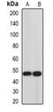 Hemojuvelin BMP Co-Receptor antibody, abx225214, Abbexa, Western Blot image 