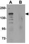 Rho Associated Coiled-Coil Containing Protein Kinase 1 antibody, GTX31836, GeneTex, Western Blot image 