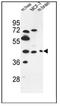 Pregnancy Specific Beta-1-Glycoprotein 3 antibody, AP53481PU-N, Origene, Western Blot image 