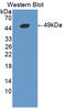 Lipolysis Stimulated Lipoprotein Receptor antibody, LS-C373180, Lifespan Biosciences, Western Blot image 