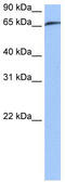 Rab Geranylgeranyltransferase Subunit Alpha antibody, TA331013, Origene, Western Blot image 