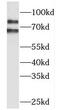 Melanophilin antibody, FNab05120, FineTest, Western Blot image 