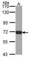 Lymphocyte Cytosolic Protein 1 antibody, PA5-30078, Invitrogen Antibodies, Western Blot image 