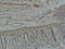 Galectin 3 antibody, GTX34032, GeneTex, Immunohistochemistry paraffin image 