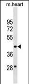 Molybdenum Cofactor Synthesis 3 antibody, PA5-49184, Invitrogen Antibodies, Western Blot image 